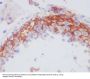Anti-Integrin beta 3 ITGB3 Rabbit Monoclonal Antibody