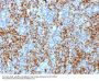 Anti-CD61 / Integrin beta-3 / Platelet Glycoprotein IIIa (Platelet Marker) ITGB3 Monoclonal Antibody