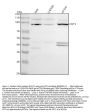 Anti-Transferrin Receptor (CD71) TFRC Rabbit Monoclonal Antibody