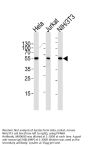 Anti-PPARA Antibody