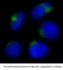 Anti-ADAM17/Tace Rabbit Monoclonal Antibody