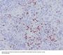 Anti-LEF1 Rabbit Monoclonal Antibody