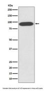 Anti-VCP Rabbit Monoclonal Antibody