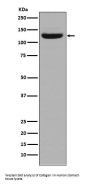 Anti-Collagen I COL1A1 Rabbit Monoclonal Antibody