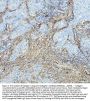 Anti-Collagen I COL1A1 Rabbit Monoclonal Antibody