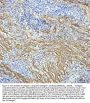 Anti-Collagen I COL1A1 Rabbit Monoclonal Antibody