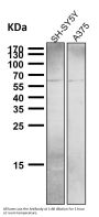 Anti-NUR77 NR4A1 Rabbit Monoclonal Antibody