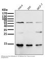 Anti-Sumo 1 Rabbit Monoclonal Antibody