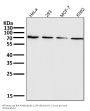 Anti-PRMT5 Rabbit Monoclonal Antibody
