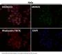Anti-PRMT5 Rabbit Monoclonal Antibody