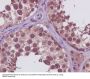 Anti-PRMT5 Rabbit Monoclonal Antibody