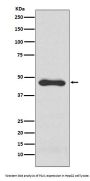 Anti-PAI1 Rabbit Monoclonal Antibody