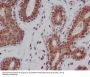 Anti-DNA-PKcs PRKDC Rabbit Monoclonal Antibody
