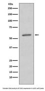 Anti-SGK1/Sgk Rabbit Monoclonal Antibody