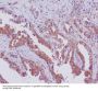 Anti-SGK1/Sgk Rabbit Monoclonal Antibody