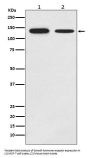 Anti-Growth hormone receptor Rabbit Monoclonal Antibody