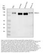 Anti-TrkA NTRK1 Rabbit Monoclonal Antibody
