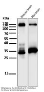 Anti-TrkA+B+C NTRK1 Rabbit Monoclonal Antibody