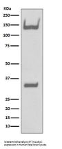 Anti-TrkA+B+C NTRK1 Rabbit Monoclonal Antibody