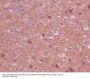 Anti-TrkA+B+C NTRK1 Rabbit Monoclonal Antibody