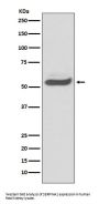 Anti-SERPINA1/Alpha 1 Antitrypsin Rabbit Monoclonal Antibody
