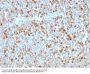 Anti-Alpha-1-Antitrypsin (SERPINA1) (Hepatocellular & Histiocytic Marker) Monoclonal Antibody