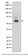 Anti-Smad1 Rabbit Monoclonal Antibody