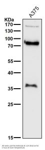 Anti-L1CAM Rabbit Monoclonal Antibody