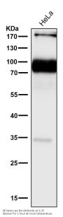 Anti-L1CAM Rabbit Monoclonal Antibody