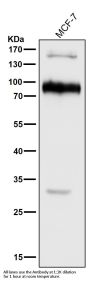 Anti-L1CAM Rabbit Monoclonal Antibody