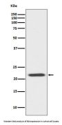 Anti-Bid Rabbit Monoclonal Antibody