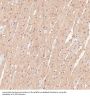 Anti-p95/NBS1 NBN Rabbit Monoclonal Antibody