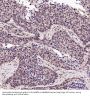 Anti-p95/NBS1 NBN Rabbit Monoclonal Antibody