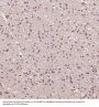 Anti-p95/NBS1 NBN Rabbit Monoclonal Antibody