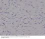 Anti-p95/NBS1 NBN Rabbit Monoclonal Antibody