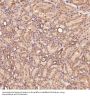 Anti-MMP1 Rabbit Monoclonal Antibody