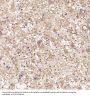 Anti-MMP1 Rabbit Monoclonal Antibody