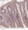 Anti-MMP1 Rabbit Monoclonal Antibody
