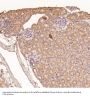 Anti-MMP1 Rabbit Monoclonal Antibody