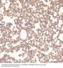Anti-MMP1 Rabbit Monoclonal Antibody