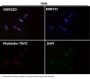 Anti-MMP1 Rabbit Monoclonal Antibody