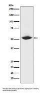 Anti-MMP1 Rabbit Monoclonal Antibody