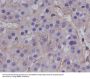 Anti-MMP1 Rabbit Monoclonal Antibody