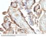Anti-HCG Holo (Pregnancy & Choriocarcinoma Marker) Monoclonal Antibody