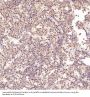 Anti-PKC alpha PRKCA Rabbit Monoclonal Antibody