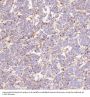 Anti-PKC alpha PRKCA Rabbit Monoclonal Antibody