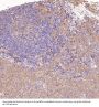 Anti-PKC alpha PRKCA Rabbit Monoclonal Antibody