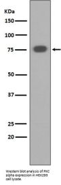 Anti-PKC alpha PRKCA Rabbit Monoclonal Antibody