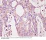 Anti-PKC alpha PRKCA Rabbit Monoclonal Antibody
