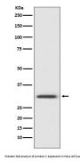 Anti-Annexin V ANXA5 Rabbit Monoclonal Antibody